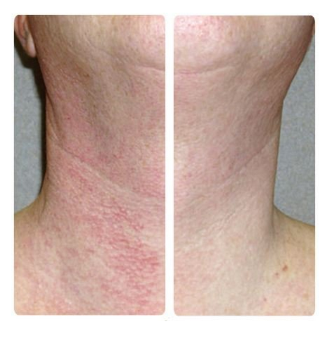 aftershavebeforeandafter1.png aftershavebeforeandafter1.png