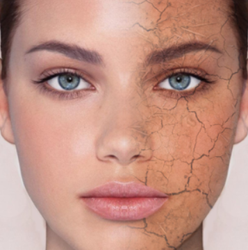 dryskin.png dryskin.png